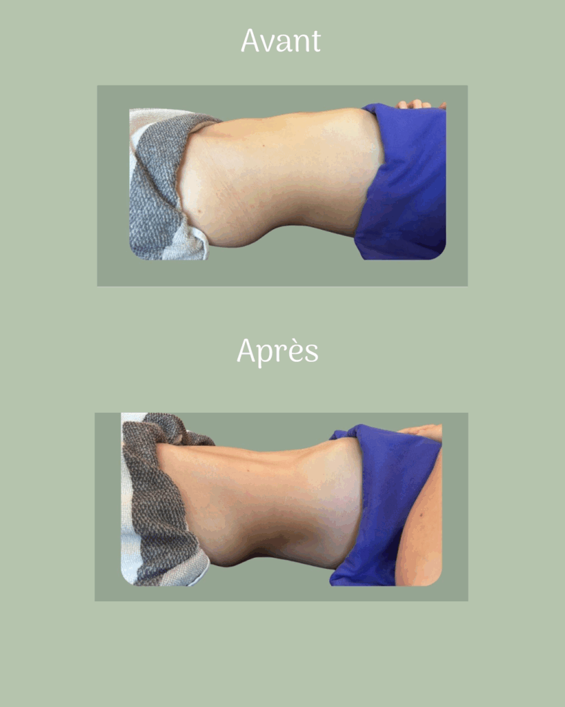 Avant / Après drainage